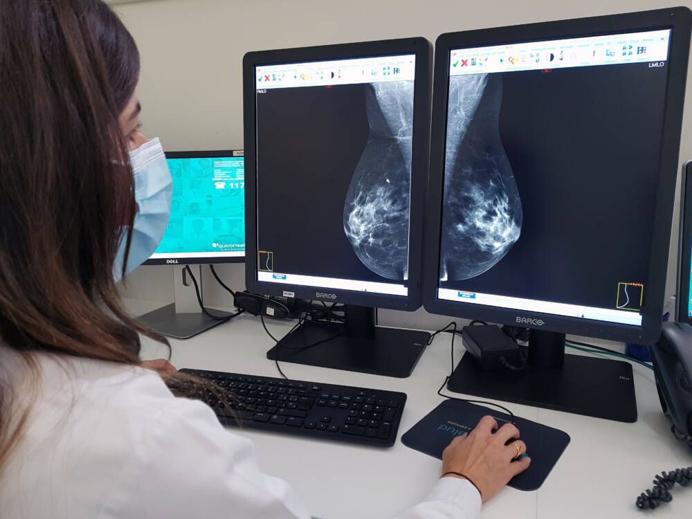 mamografía_quirónsalud_marbella_campodegibraltar _algeciras