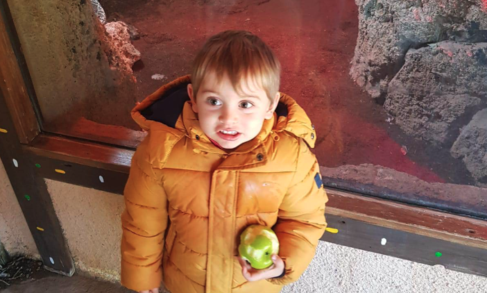 Roberto, de tres años: "Así es mi vida con el síndrome de capos" 