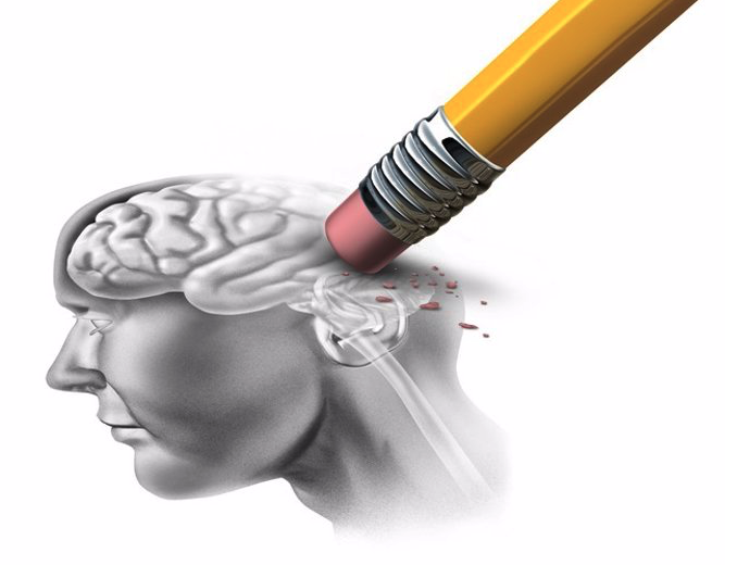 La EMA da luz verde a 'Leqembi', el primer tratamiento para el Alzheimer. Archivo - Demencia, Alzheimer - GETTY IMAGES/ISTOCKPHOTO / WILDPIXEL - Archivo.
