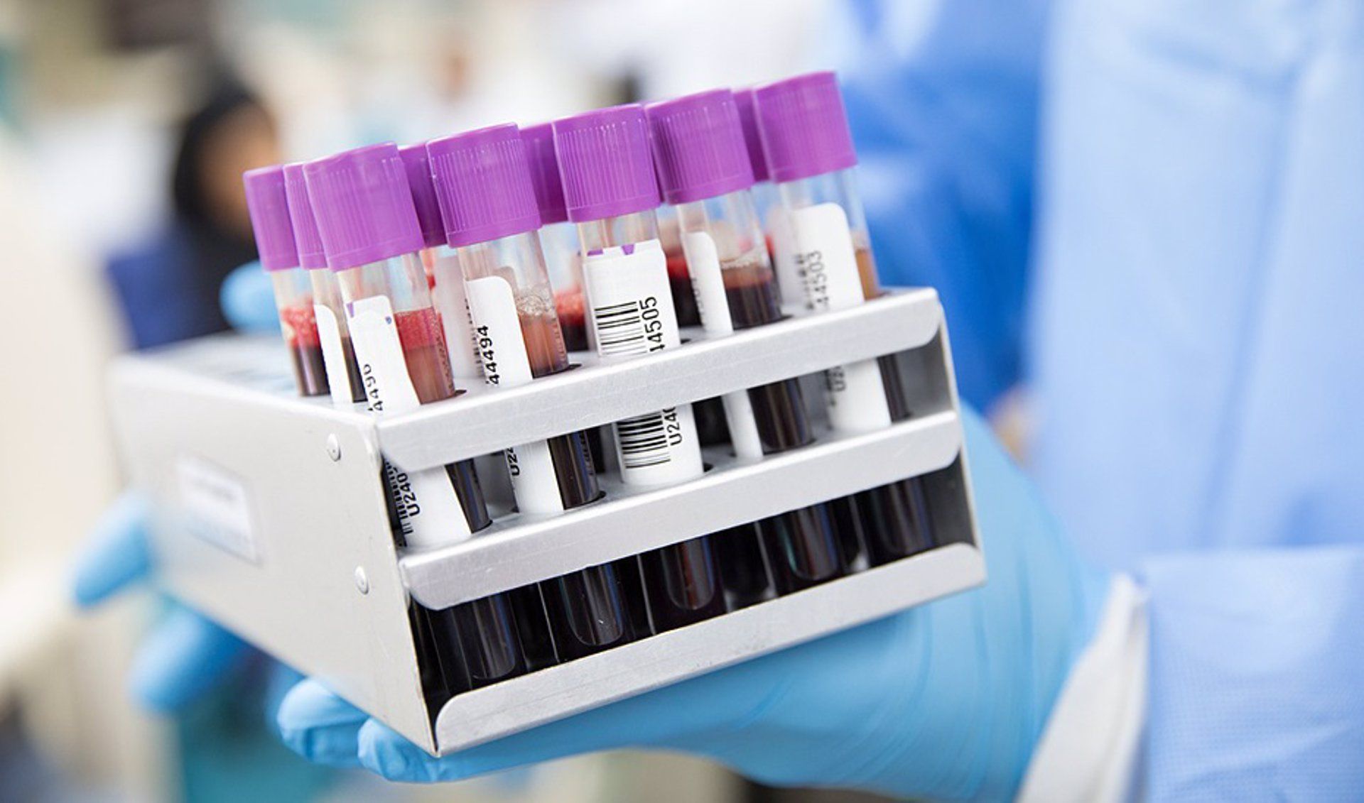 Andalucía prepara un protocolo para aplicar inteligencia artificial para predecir riesgos de complicaciones de hemofilia