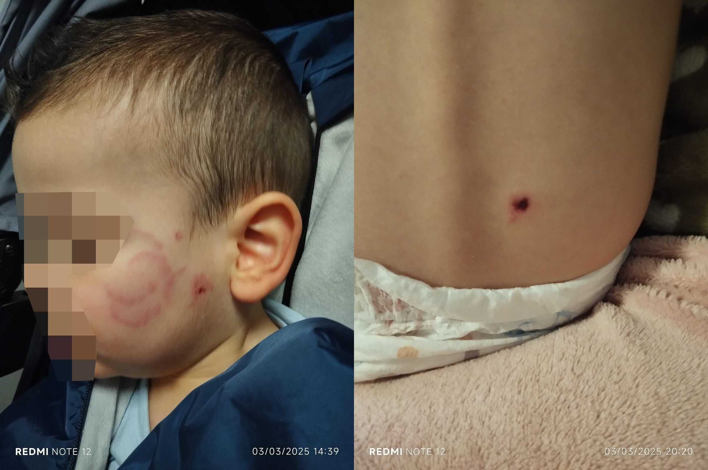 Una familia de Algeciras denuncia lesiones a su hijo de 21 meses en una guardería de Algeciras. Imagen de la familia cedida a este medio.