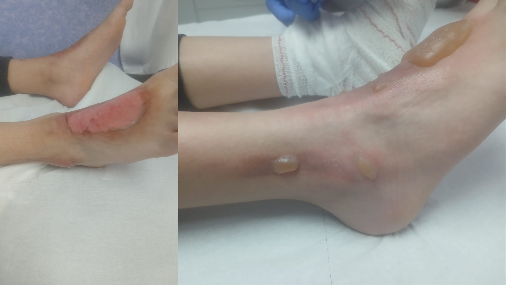 Los padres del menor agredido en Los Barrios reclamarán daños por vía civil tras el archivo de la Fiscalía de Menores Los padres del menor agredido en Los Barrios reclamarán daños por vía civil tras el archivo de la Fiscalía de Menores