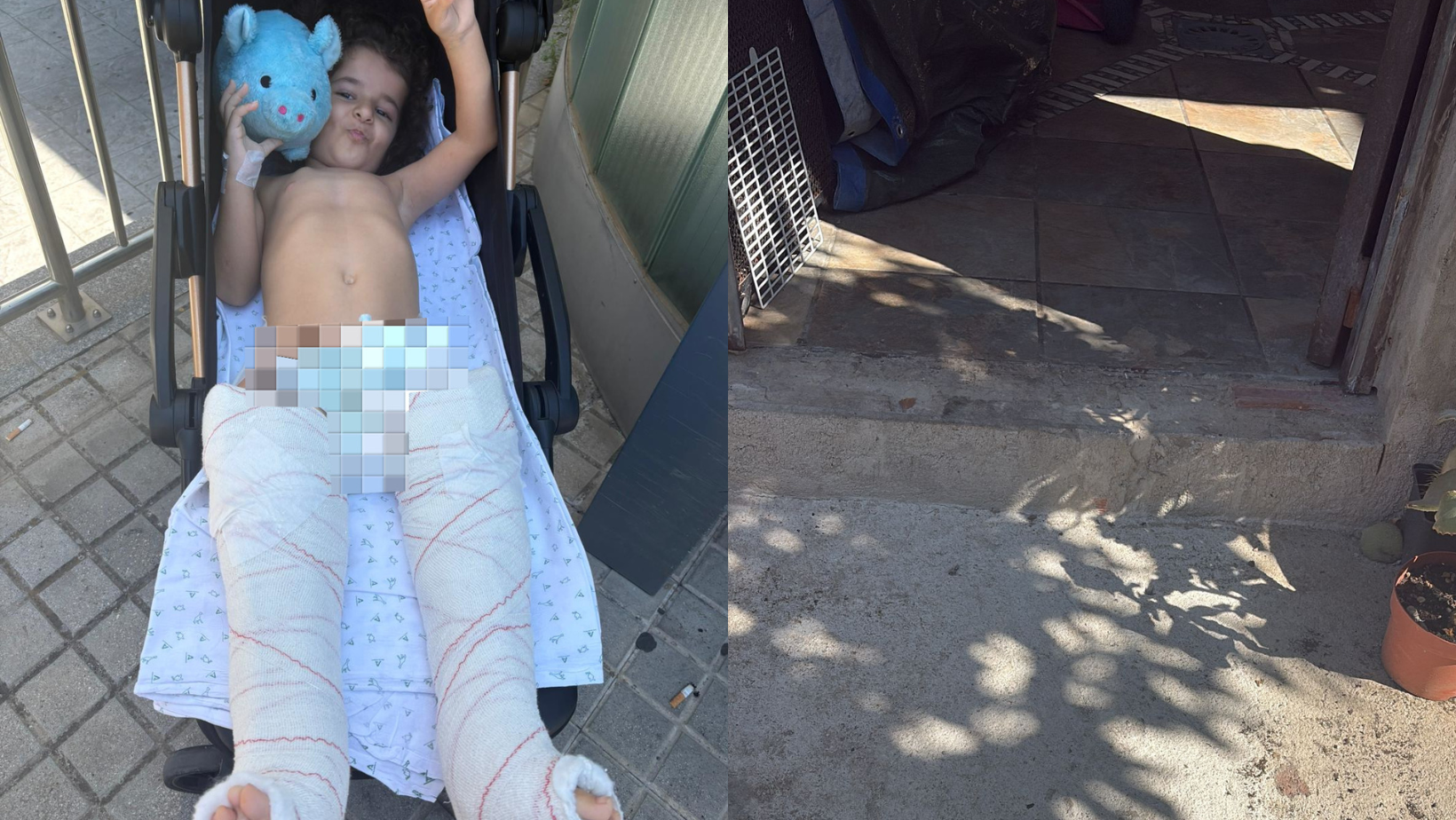 La familia de la sanroqueña con huesos de cristal pide al Ayuntamiento una rampa para acceder a su vivienda. Fotos cedidas a este medio.