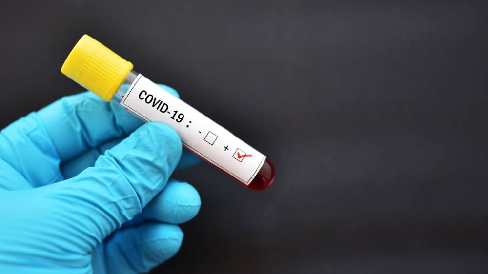 Blood sample tube positive with COVID-19