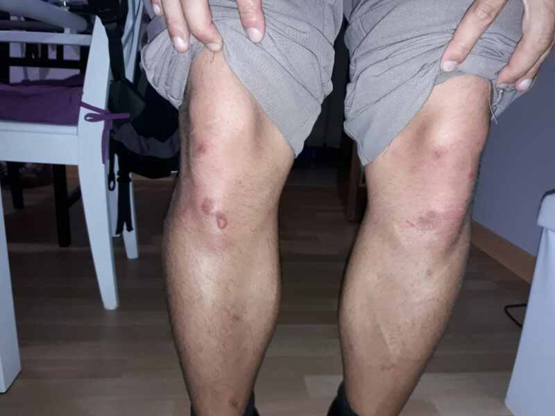 agresiones marchenilla agresiones marchenilla